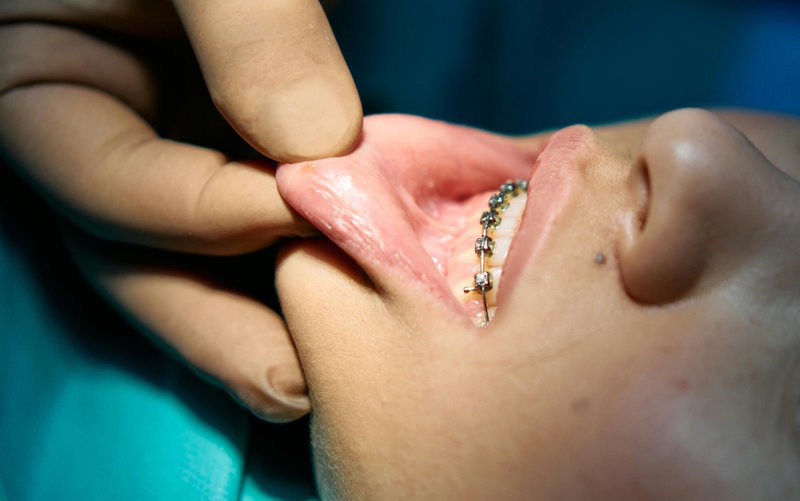 Zwei Leistungen jetzt auch für Kinder